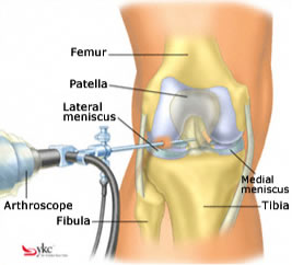 knee-joint-pain-treatment-options