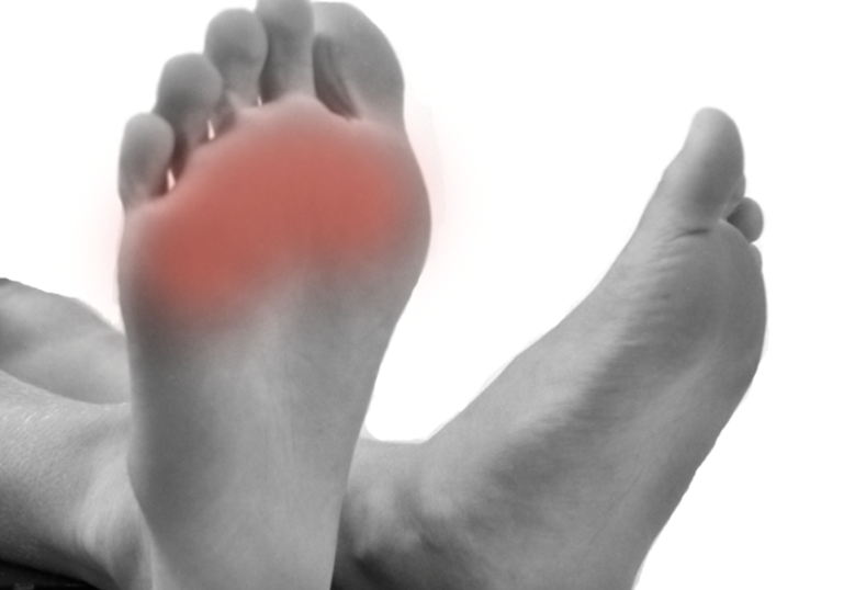 ankle-foot pain